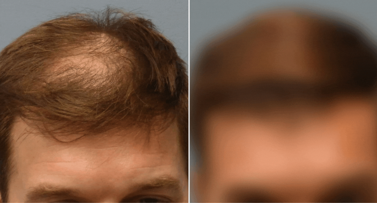 spray capelli recensione